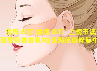 优玛 🦅 除疤 🐴 上榜玉溪十强整形美容机构(优玛疤痕修复中心(总店)怎么样)